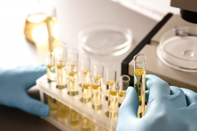 Ako primetite ovu promenu kada mokrite, odmah se javite lekaru